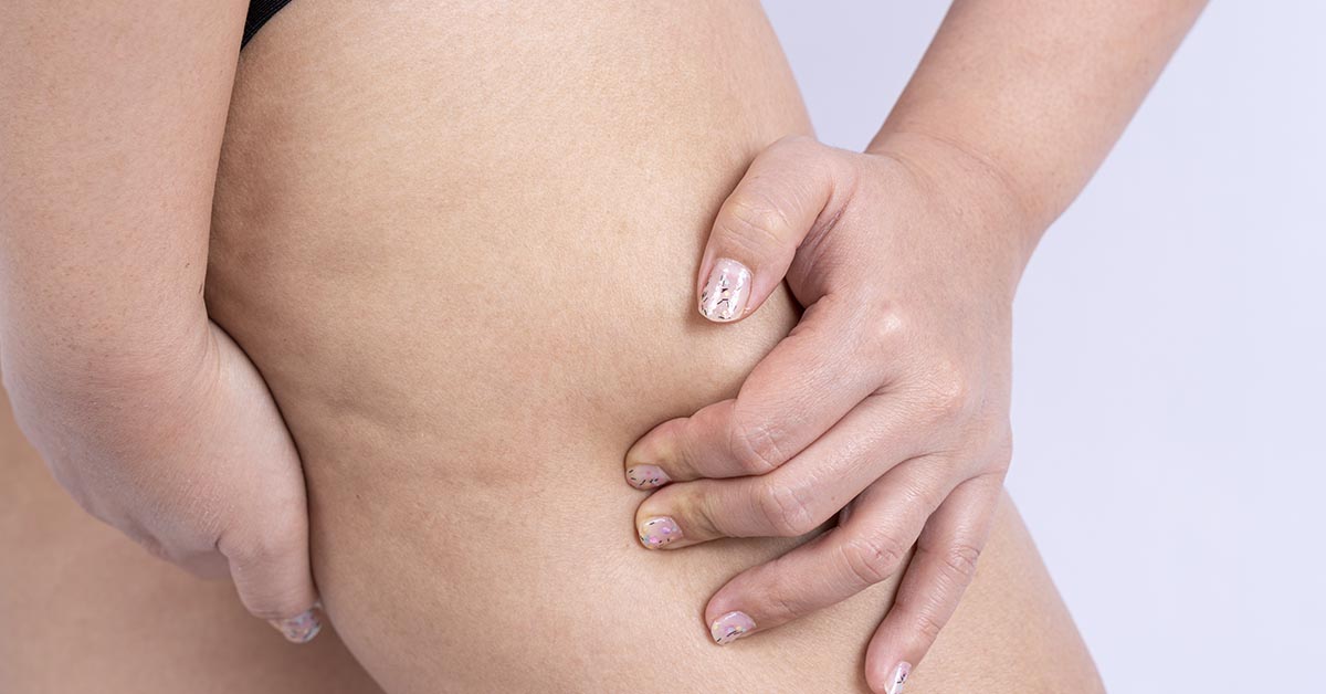 Cuidados pós-operatórios para pacientes de cruroplastia